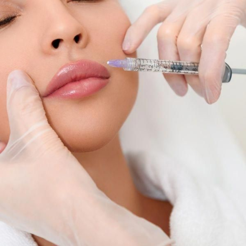 Lip Filler Techniques